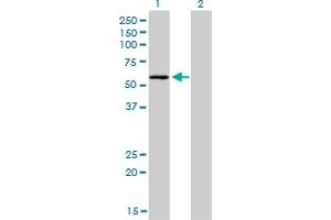 Western Blot analysis of STK38 expression in transfected 293T cell line by STK38 monoclonal antibody (M04), clone 2F3. (STK38 Antikörper  (AA 365-465))
