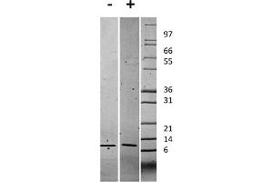 SDS-PAGE of Human Gro Alpha (CXCL1) Recombinant Protein SDS-PAGE of Human Gro Alpha (CXCL1) Recombinant Protein. (CXCL1 Protein)