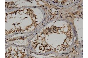Image no. 1 for anti-Regulator of G-Protein Signaling 14 (RGS14) (AA 1-567) antibody (ABIN599517) (RGS14 Antikörper  (AA 1-567))