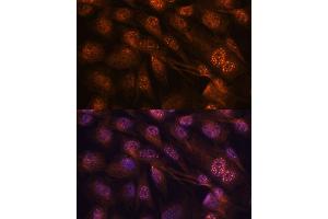 Immunofluorescence analysis of C6 cells using MEK7 antibody (ABIN3023156, ABIN3023157, ABIN3023158 and ABIN6219416) at dilution of 1:100. (MAP2K7 Antikörper  (AA 1-250))