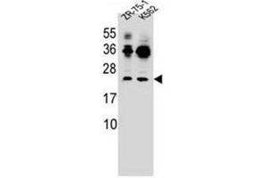 Western blot analysis of FRAT2 Antibody (C-term) in ZR-75-1,K562 cell line lysates (35ug/lane). (FRAT2 Antikörper  (C-Term))