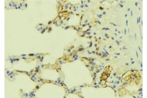 ABIN6277672 at 1/100 staining Mouse lung tissue by IHC-P. (ECE1 Antikörper  (N-Term))