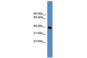 WB Suggested Anti-UBLCP1 Antibody Titration: 0.