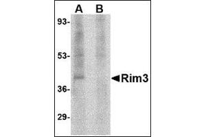 Western blot analysis of Rim3 in human brain tissue lysate with this product at 1 μg/ml in the (A) absence and (B) presence of blocking peptide. (RIMS3 Antikörper  (N-Term))