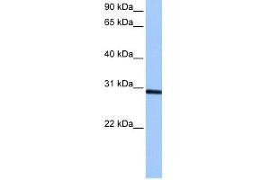 WB Suggested Anti-ASB11 Antibody Titration: 0. (ASB11 Antikörper  (C-Term))
