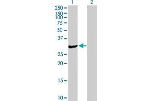Western Blot analysis of ASB9 expression in transfected 293T cell line by ASB9 MaxPab polyclonal antibody. (ASB9 Antikörper  (AA 1-294))