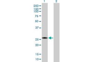 Western Blot analysis of RGS2 expression in transfected 293T cell line by RGS2 MaxPab polyclonal antibody. (RGS2 Antikörper  (AA 1-211))