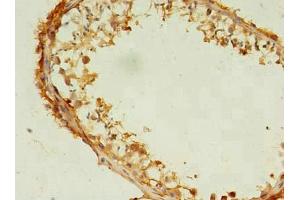 Immunohistochemistry of paraffin-embedded human testis tissue using ABIN7171437 at dilution of 1:100 (CCT6B Antikörper  (AA 101-330))