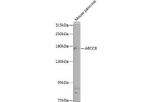 Western blot analysis of extracts of mouse pancreas, using  antibody (ABIN6129856, ABIN6136367, ABIN6136368 and ABIN6224521) at 1:1000 dilution. (ABCC8 Antikörper  (AA 700-1000))