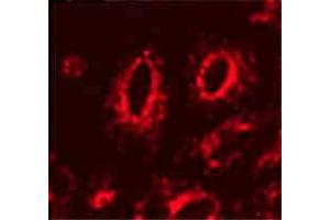 Lamp1 (Ly1C6), IF in transfected HeLa cells  Courtesy of Robert H Edwards, U of Cali, San Fran School of Medicine. (LAMP1 Antikörper)