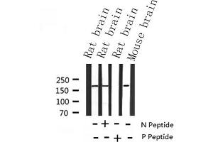 IRS1 anticorps  (pSer639)
