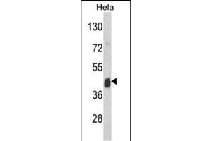 Western Blotting (WB) image for anti-Argininosuccinate Synthase 1 (ASS1) (AA 192-221) antibody (ABIN390810)