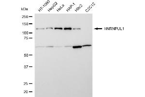 Western blotting analysis using HNRNPUL1 antibody (ABIN7798904). (Rekombinanter HNRNPUL1 Antikörper)