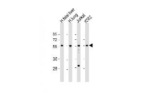 EFS Antikörper  (AA 367-399)
