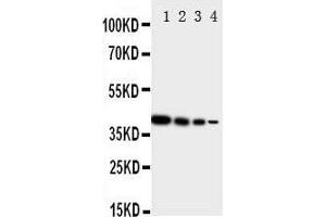 Lane 4: Recombinant Human ERRB4 Protein 1. (ERBB4 Antikörper  (N-Term))