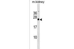 FGF20 Antibody (C-term) (ABIN1536710 and ABIN2838307) western blot analysis in mouse kidney tissue lysates (35 μg/lane). (FGF20 Antikörper  (C-Term))