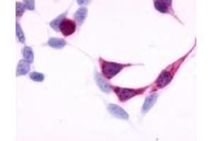 Immunocytochemistry (ICC) image for anti-Endothelin Receptor Type B (EDNRB) (N-Term) antibody (ABIN1048557)