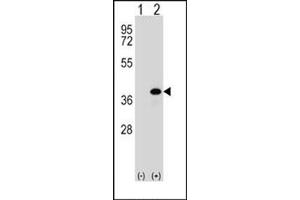 Image no. 2 for anti-Aldo-Keto Reductase Family 1, Member B1 (Aldose Reductase) (AKR1B1) (AA 287-316), (C-Term) antibody (ABIN357880) (AKR1B1 Antikörper  (C-Term))