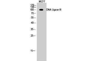 Western Blotting (WB) image for anti-Ligase III, DNA, ATP-Dependent (LIG3) (Internal Region) antibody (ABIN3184322)