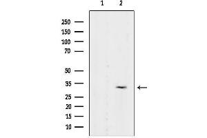 Western blot analysis of lysates from Serum-starved EC304 cells, using Phospho-DARPP-32 (Ser97) Antibody.