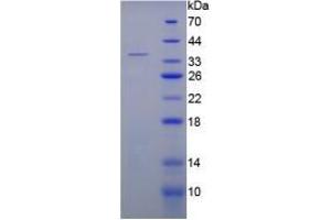 SDS-PAGE analysis of Rat C5a Protein. (C5A Protein)