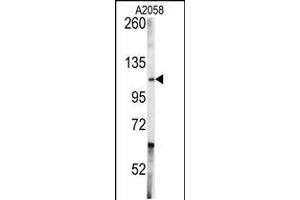 Western blot analysis of anti-ABL1 Antibody in A2058 cell line lysates (35ug/lane) (ABL1 Antikörper  (AA 741-769))
