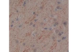 IHC-P analysis of Human Tissue, with DAB staining. (IFNA10 Antikörper  (AA 24-189))