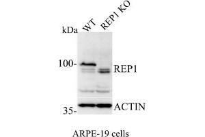 Western Blotting (WB) image for anti-Choroideremia (Rab Escort Protein 1) (CHM) (C-Term) antibody (ABIN6254222) (CHM Antikörper  (C-Term))