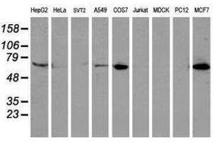 Image no. 3 for anti-Epsin 2 (EPN2) antibody (ABIN1498052) (Epsin 2 Antikörper)