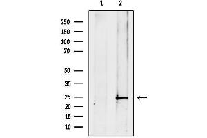 Western blot analysis of lysates from Mouse spleen, using ATP6V1E1 Antibody.