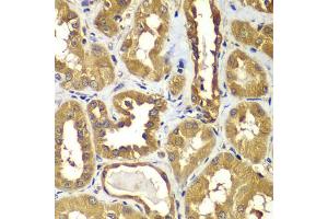 Immunohistochemistry of paraffin-embedded human kidney using RAB1B antibody (ABIN4904923) at dilution of 1:100 (40x lens).