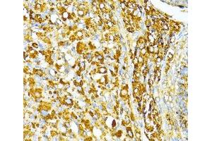 Immunohistochemistry of paraffin-embedded Rat ovary using VAMP1 Polyclonal Antibody at dilution of 1:100 (40x lens).
