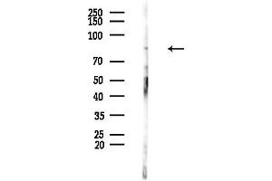 Western blot analysis of lysates from EC304 cells, using SLC6 Antibody at 1/1000 dilution.