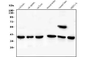 Western blot analysis of PPID using anti-PPID antibody (ABIN6719438).
