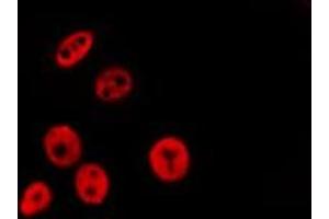 ABIN6277206 staining HepG2 by IF/ICC.