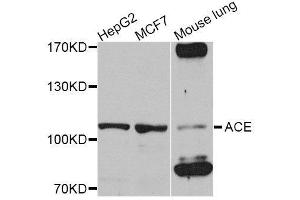 Western blot analysis of extracts of various cell lines, using ACE antibody. (Angiotensin I Converting Enzyme 1 Antikörper  (AA 30-270))
