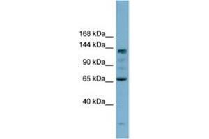Image no. 1 for anti-Isoleucyl-tRNA Synthetase (IARS) (AA 35-84) antibody (ABIN6741923) (IARS Antikörper  (AA 35-84))