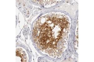 Immunohistochemical staining of human breast with RIMBP3 polyclonal antibody  shows strong cytoplasmic positivity in cells in seminiferus ducts. (RIMBP3 Antikörper)