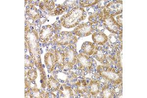 Immunohistochemistry of paraffin-embedded rat kidney using ANAPC5 antibody at dilution of 1:100 (x400 lens). (ANAPC5 Antikörper)