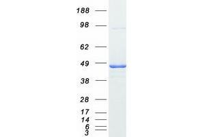 Western Blotting (WB) image for Protein Kinase, CAMP-Dependent, Regulatory, Type I, alpha (Tissue Specific Extinguisher 1) (PRKAR1A) (Transcript Variant 3) protein (Myc-DYKDDDDK Tag) (ABIN2729582)