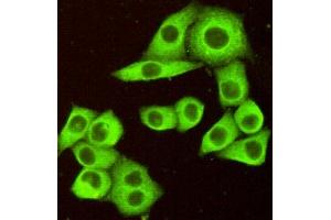 Immunocytochemistry of HeLa cells fixed by Paraformaldehyde and using DR5 mouse mAb diluted 1:100. (TNFRSF10B Antikörper)