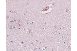 Immunohistochemistry of ZNF536 in human brain tissue with this product at 5 μg/ml. (ZNF536 Antikörper  (N-Term))