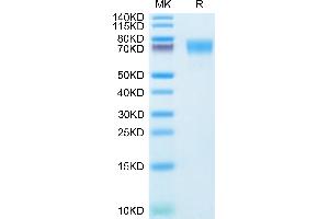 Human ICAM-1 on Tris-Bis PAGE under reduced condition. (ICAM1 Protein (AA 28-480) (His tag))