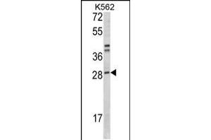 Western blot analysis of ITGB1BP3 Antibody in K562 cell line lysates (35ug/lane)