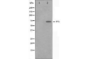 Western blot analysis on Jurkat cell lysate using p73 Antibody. (Tumor Protein p73 Antikörper  (Internal Region))