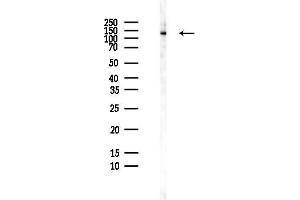 anti-Diacylglycerol Kinase, delta 130kDa (DGKD) (N-Term) antibody