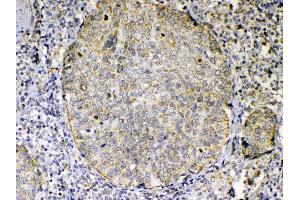 Immunohistochemistry (IHC) image for anti-Tumor Necrosis Factor (Ligand) Superfamily, Member 18 (TNFSF18) (AA 70-199) antibody (ABIN5519067)