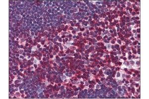 Immunohistochemistry (IHC) image for anti-CD247 Molecule (CD247) (AA 1-165) antibody (ABIN782349)