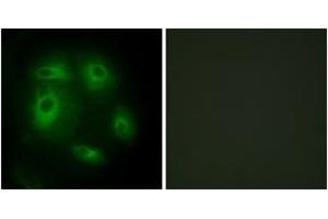 Immunofluorescence analysis of HeLa cells, using DLEC1 Antibody. (DLEC1 Antikörper  (AA 1-50))