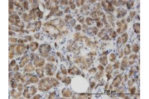 Image no. 1 for anti-Glycine N-Acyltransferase (GLYAT) (AA 64-164) antibody (ABIN599511) (GLYAT Antikörper  (AA 64-164))